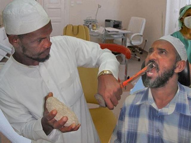 És még te félsz a fogorvostól? félelem beteg módszer fogorvos kép elvetemült