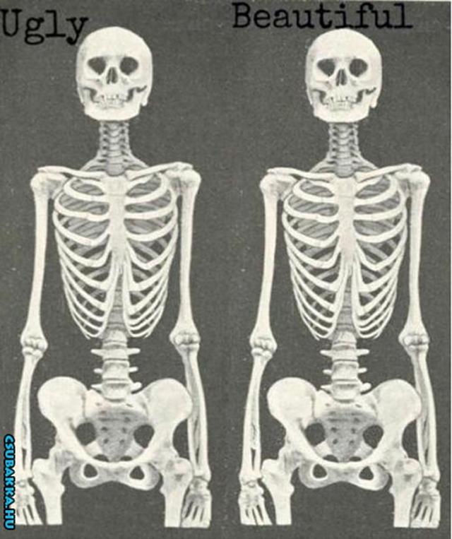 Csúnya és szép Dr. Csont szerint különbség csúnya csontváz szép semmi